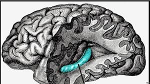 Illustration for article titled Obat Stroke Lumpuh Sebelah